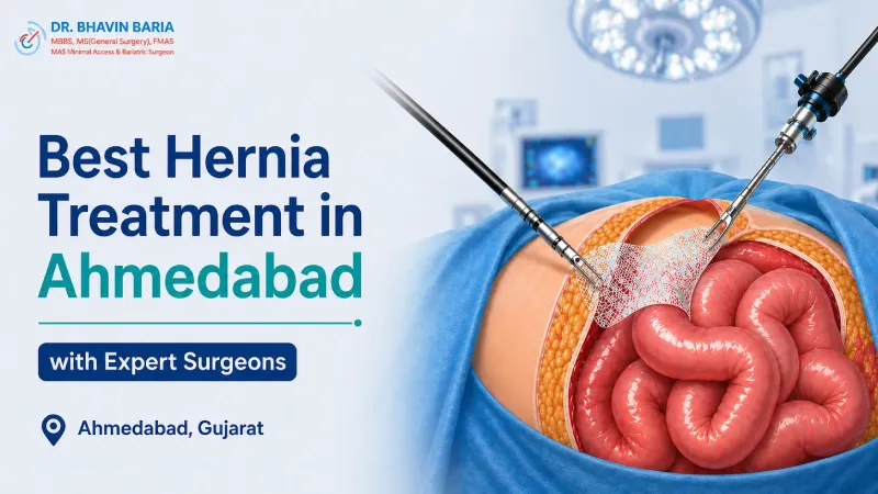 Best Hernia Treatment in Ahmedabad with Expert Surgeons