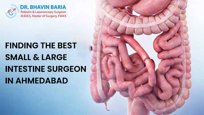 Finding the Best Small & Large Intestine Surgeon in Ahmedabad