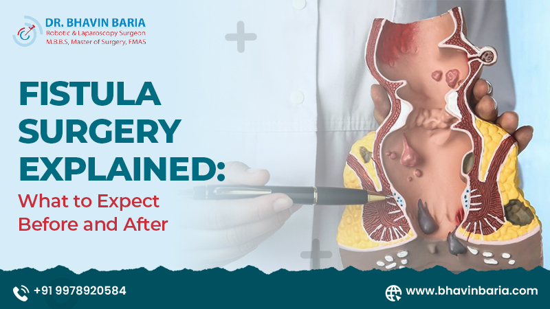Fistula Surgery Explained: What to Expect Before and After
