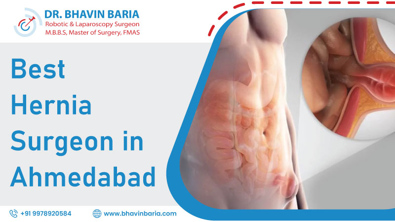 Best Hernia Surgeon in Ahmedabad