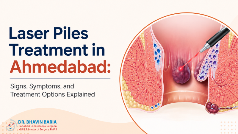 Laser Piles Treatment in Ahmedabad: Signs, Symptoms, and Treatment Options Explained