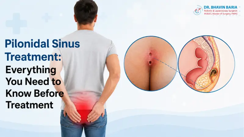 Pilonidal Sinus Treatment: Everything You Need to Know Before Treatment