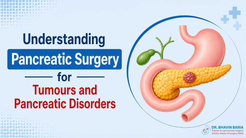 Understanding Pancreatic Surgery for Tumours and Pancreatic Disorders