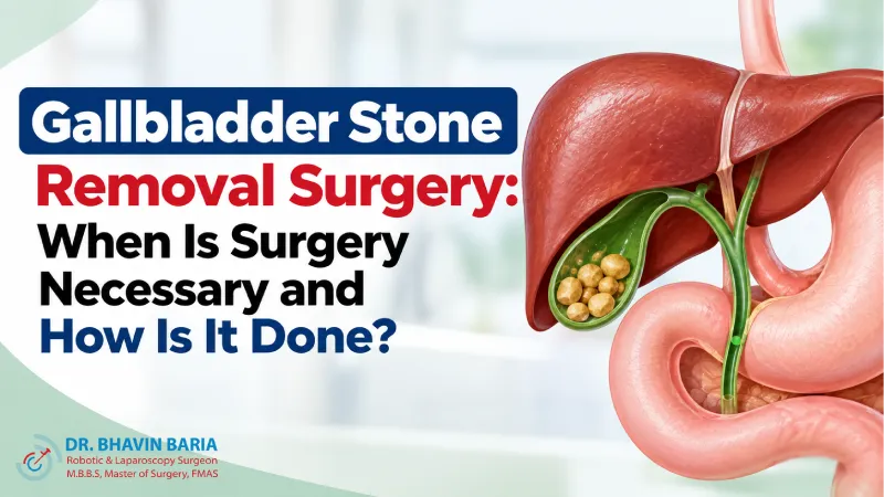 Gallbladder Stone Removal Surgery: When Is Surgery Necessary and How Is It Done?
