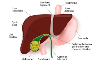 Gallbladder Stone Surgery in Ahmedabad