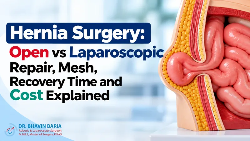 Hernia Surgery: Open vs Laparoscopic Repair, Mesh, Recovery Time and Cost Explained