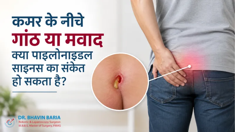 कमर के नीचे गांठ या मवाद क्या पाइलोनाइडल साइनस का संकेत हो सकता है?