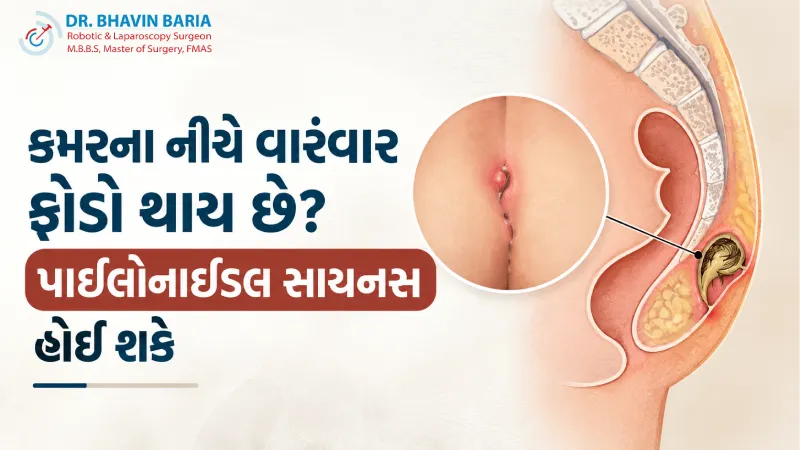 કમરના નીચે વારંવાર ફોડો થાય છે? પાઇલોનાઇડલ સાઇનસ હોઈ શકે