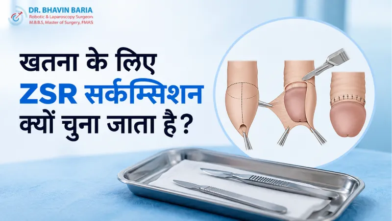 खतना के लिए ZSR सर्कम्सिशन क्यों चुना जाता है?
