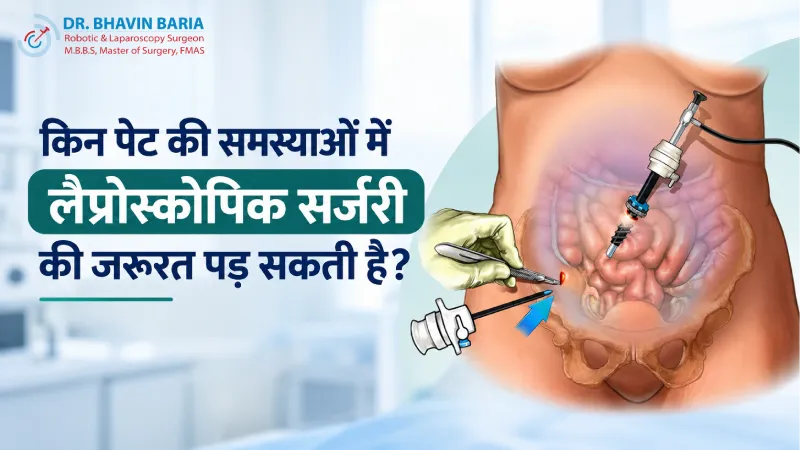 किन पेट की समस्याओं में लैप्रोस्कोपिक सर्जरी की जरूरत पड़ सकती है?
