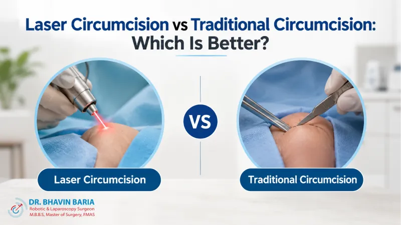 Laser Circumcision vs Traditional Circumcision: Which Is Better?