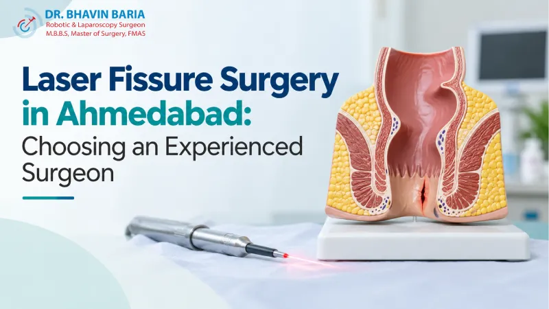 Laser Fissure Surgery in Ahmedabad: Choosing an Experienced Surgeon