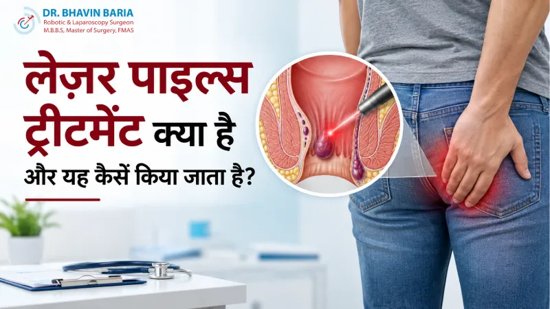 लेज़र पाइल्स ट्रीटमेंट क्या है और यह कैसे किया जाता है?