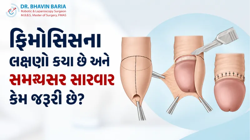 ફિમોસિસના લક્ષણો કયા છે અને સમયસર સારવાર કેમ જરૂરી છે?