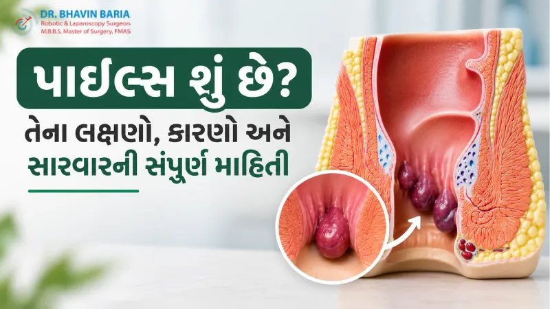 પાઇલ્સ શું છે? તેના લક્ષણો, કારણો અને સારવારની સંપૂર્ણ માહિતી