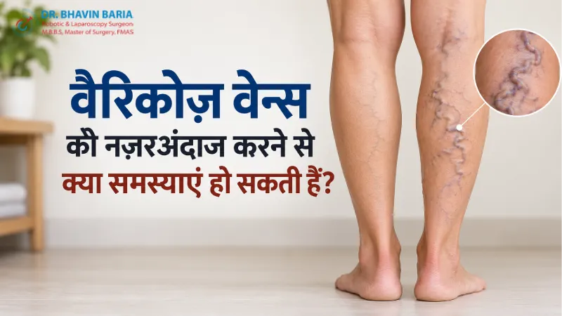 वैरिकोज़ वेन्स को नजरअंदाज करने से क्या समस्याएं हो सकती हैं?