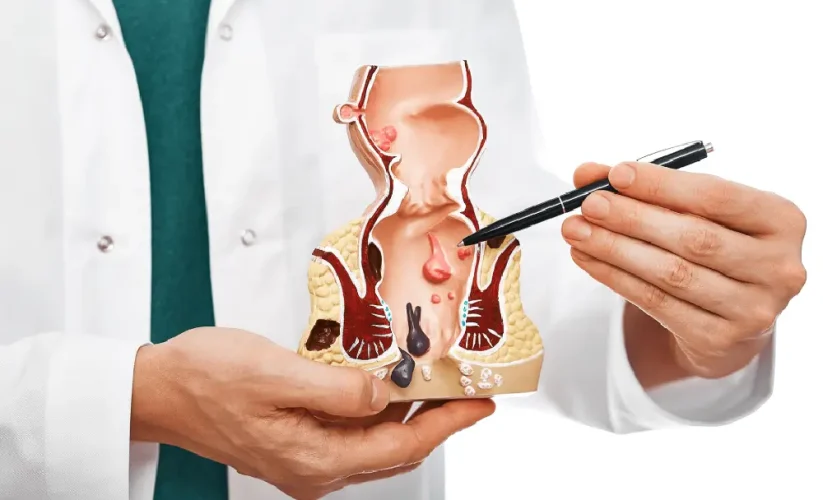 Complete Guide to Piles Treatment: Causes, Symptoms & Best Care Options