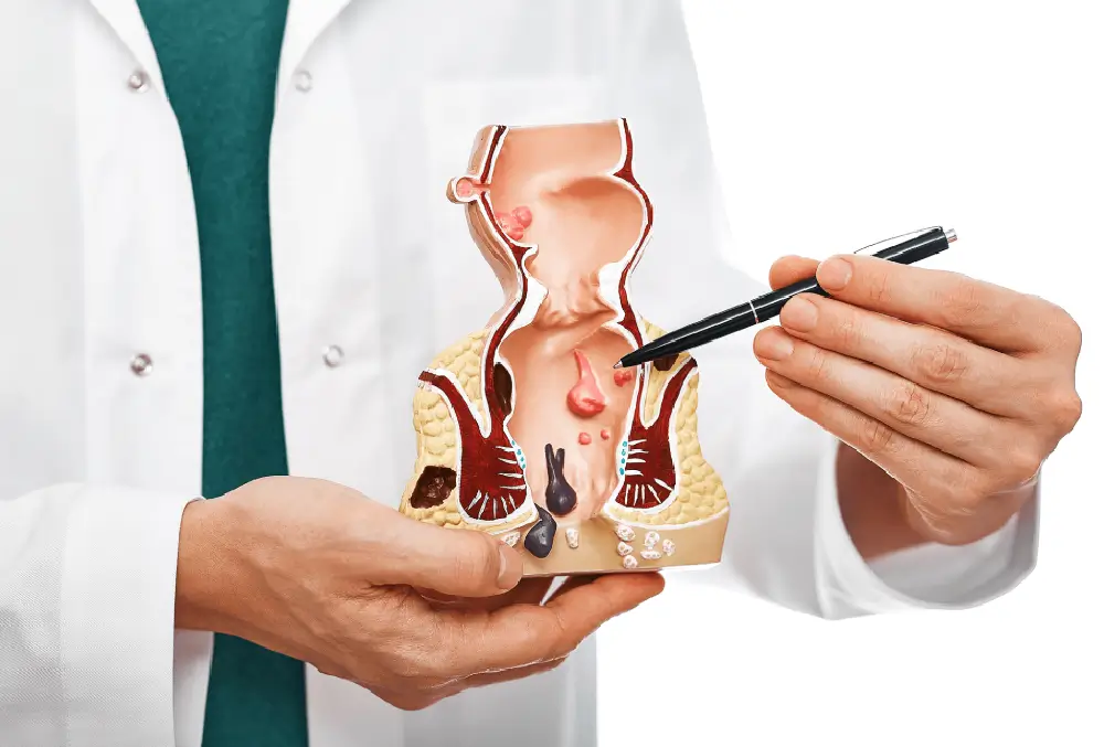 Complete Guide to Piles Treatment: Causes, Symptoms & Best Care Options