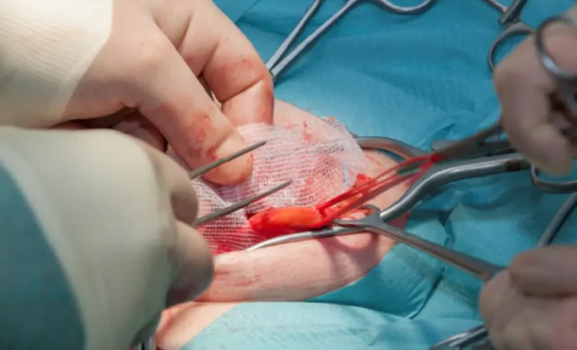 Suffering from Hernia? Explore Safe & Effective Surgery Options for Lasting Relief