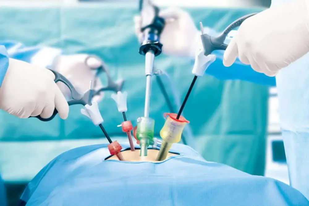 What is Laparoscopy Surgery? Discover the Benefits of Faster Healing & Less Pain