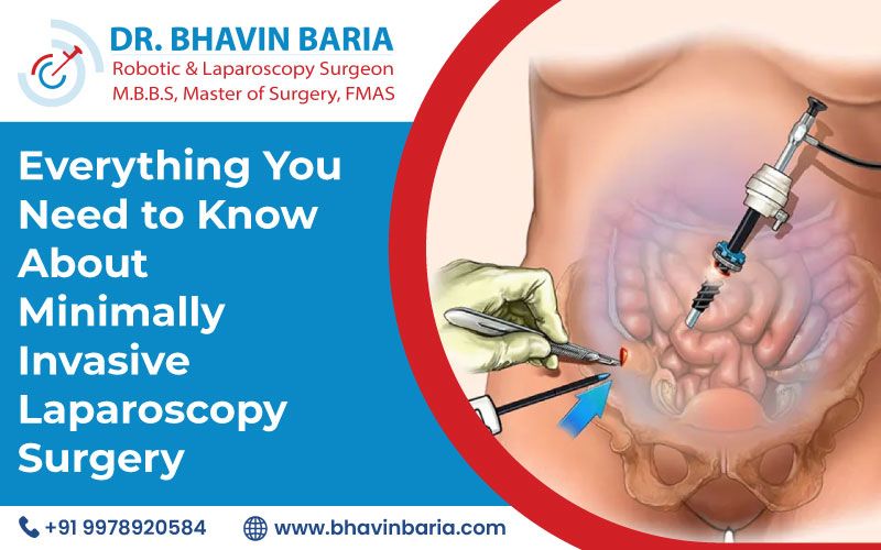 Everything You Need to Know About Minimally Invasive Laparoscopy Surgery