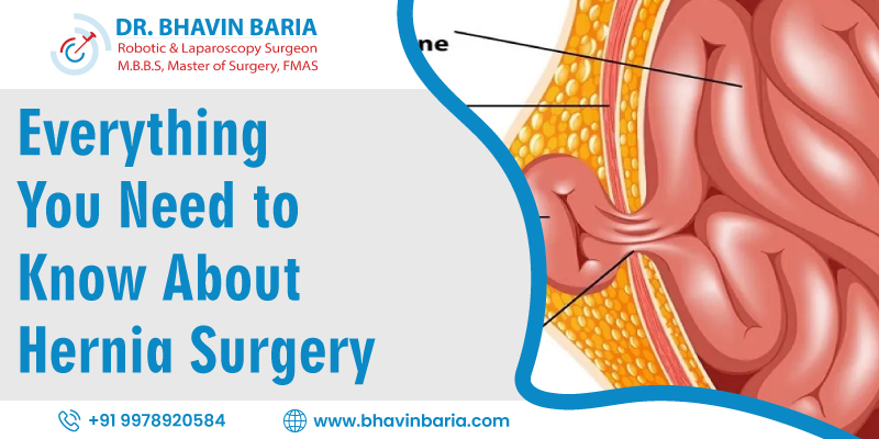 Everything You Need to Know About Hernia Surgery