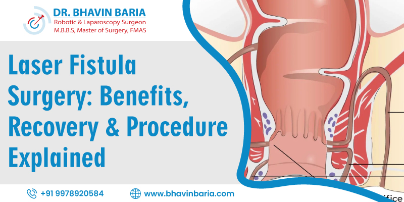 Laser Fistula Surgery: Benefits, Recovery & Procedure Explained