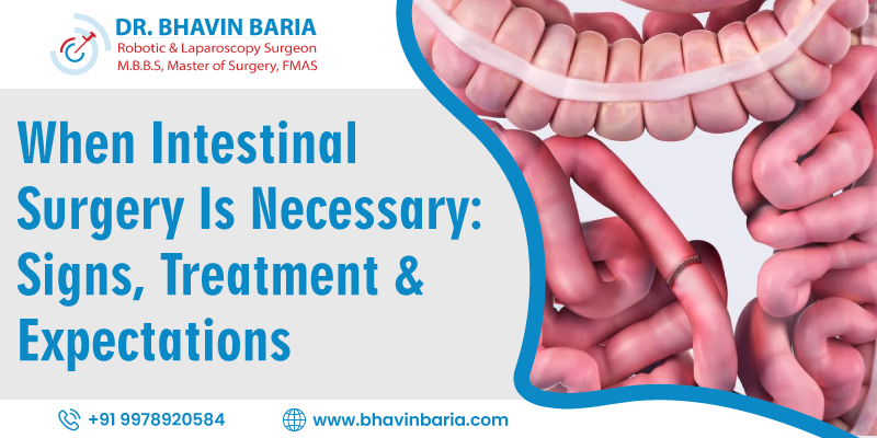 When Intestinal Surgery Is Necessary: Signs, Treatment & Expectations