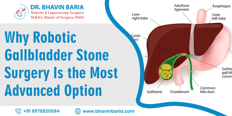 Why Robotic Gallbladder Stone Surgery Is the Most Advanced Option