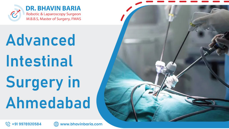 Advanced Intestinal Surgery in Ahmedabad