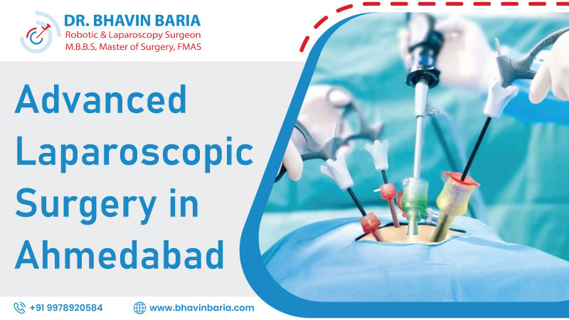 Advanced Laparoscopic Surgery in Ahmedabad