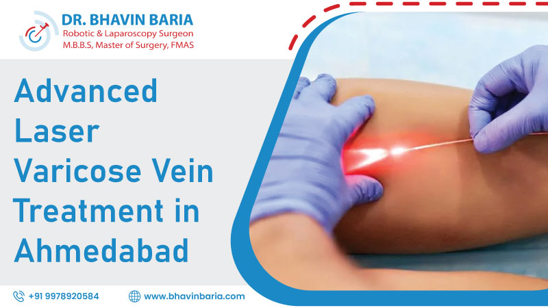 Advanced Laser Varicose Vein Treatment in Ahmedabad