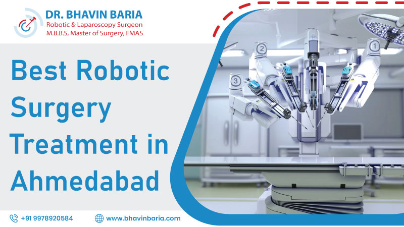 Best Robotic Surgery Treatment in Ahmedabad