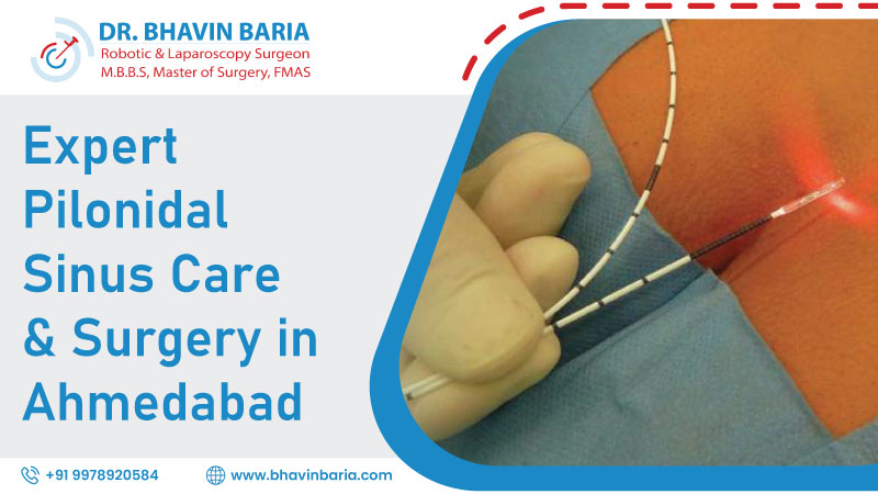 Expert Pilonidal Sinus Care & Surgery in Ahmedabad