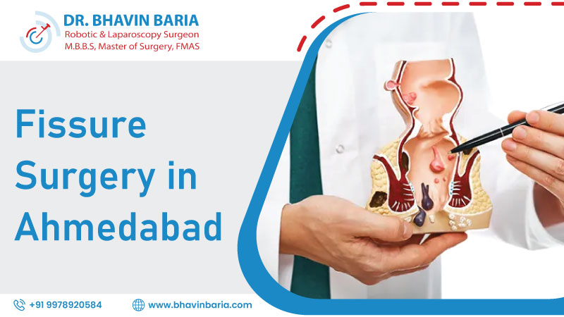 Fissure Surgery in Ahmedabad