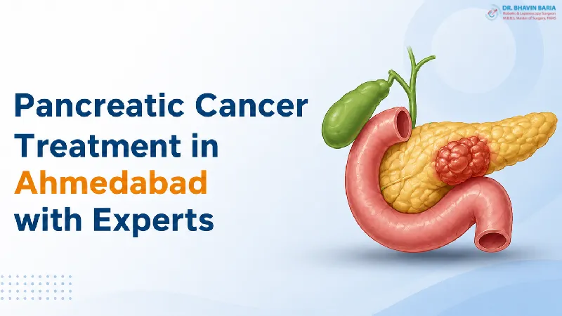Pancreatic Cancer Treatment in Ahmedabad with Experts