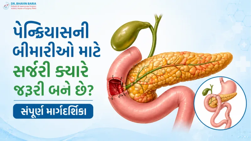 પેન્ક્રિયાસની બીમારીઓ માટે સર્જરી ક્યારે જરૂરી બને છે? સંપૂર્ણ માર્ગદર્શિકા