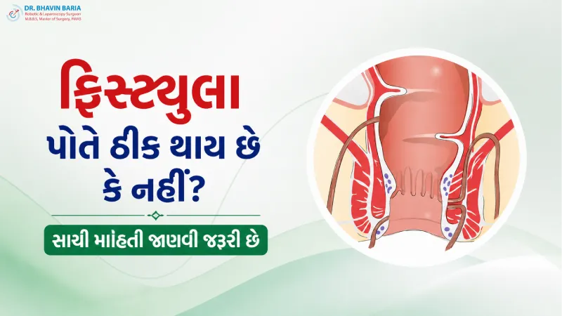 ફિસ્ટ્યુલા પોતે ઠીક થાય છે કે નહીં? સાચી માહિતી જાણવી જરૂરી છે