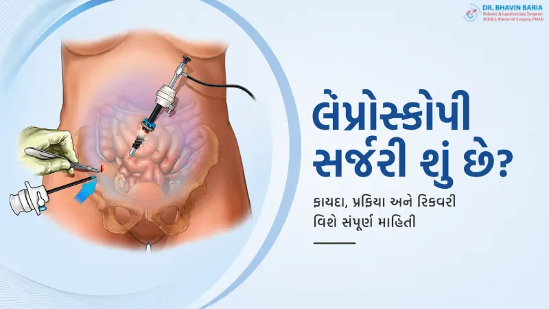 લૅપ્રોસ્કોપી સર્જરી શું છે? ફાયદા, પ્રક્રિયા અને રિકવરી વિશે સંપૂર્ણ માહિતી